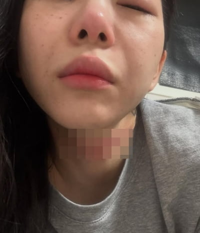 권민아, 극단적 선택 시도했다가 아쉬움 호소…"사라지겠다는 약속 지킬 거야"