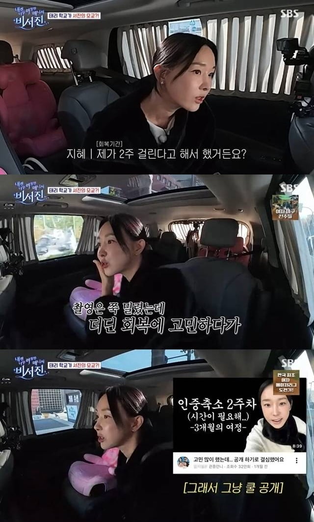 '인중 축소술' 이지혜, 결국 속내 밝혔다…"수술 후 1달 넘도록 회복 안 돼" ('비서진')[종합]