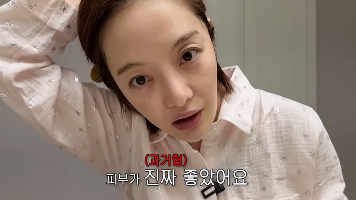 [종합] 황보라, 애 낳고 얼굴 주저앉았다…결국 피부과 시술 "기미 올라와"('보라이어티')