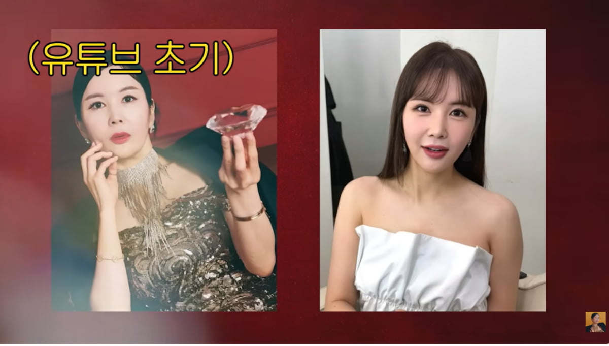 [종합] 장영란, '눈 성형만 4번'에 자녀들도 "징그럽다"…일침 당하고 충격('A급장영란')