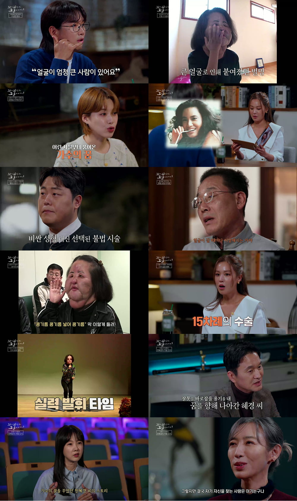 [종합] '선풍기아줌마' 사망, 불법 성형으로 망가진 삶…공업용 실리콘→콩기름 직접 주입했다 ('꼬꼬무')