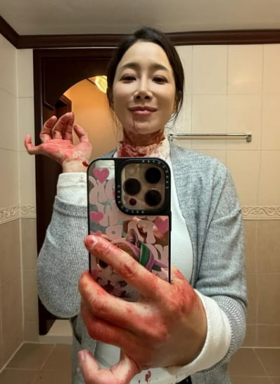 신혼여행 중 일터 잃은 김하영, 3개월 만에 '피칠갑' 얼굴로 등장