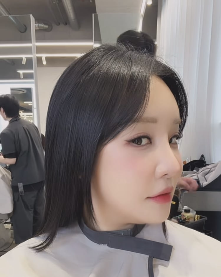 랄랄, 낮은 코에서 오똑한 코로…성형 전후 공개