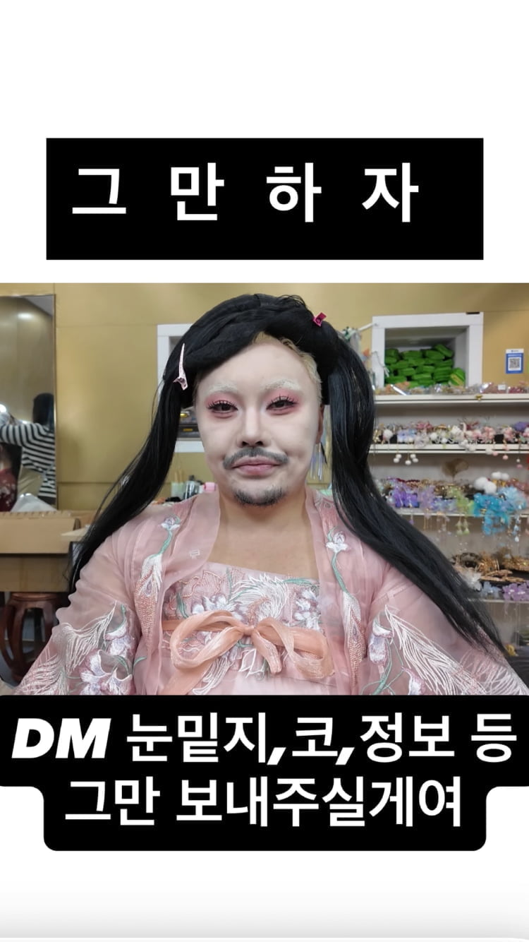 랄랄, 낮은 코에서 오똑한 코로…성형 전후 공개