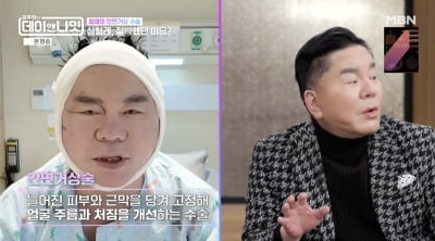 '67세' 심형래, 안면거상 2번 하더니…목주름 실종 "영구 위해 붕대 칭칭 감아" ('데이앤 나잇')