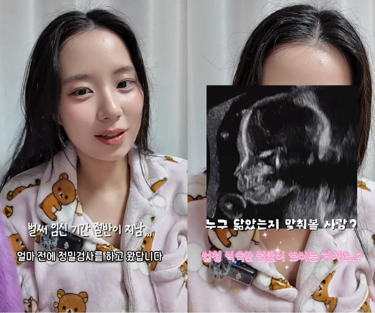 사진=최연수 SNS