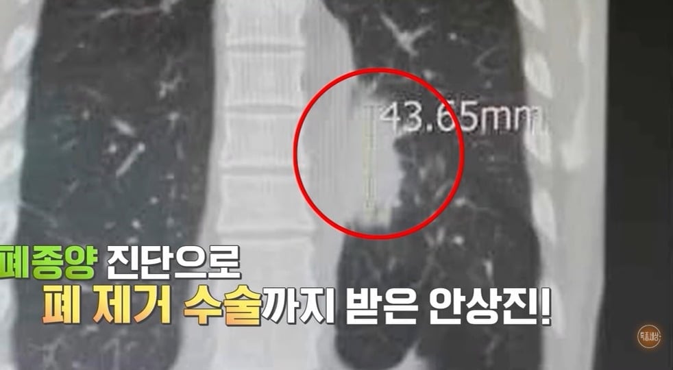 사진 = 유튜브 채널 MBN '특종세상 - 그때 그 사람'