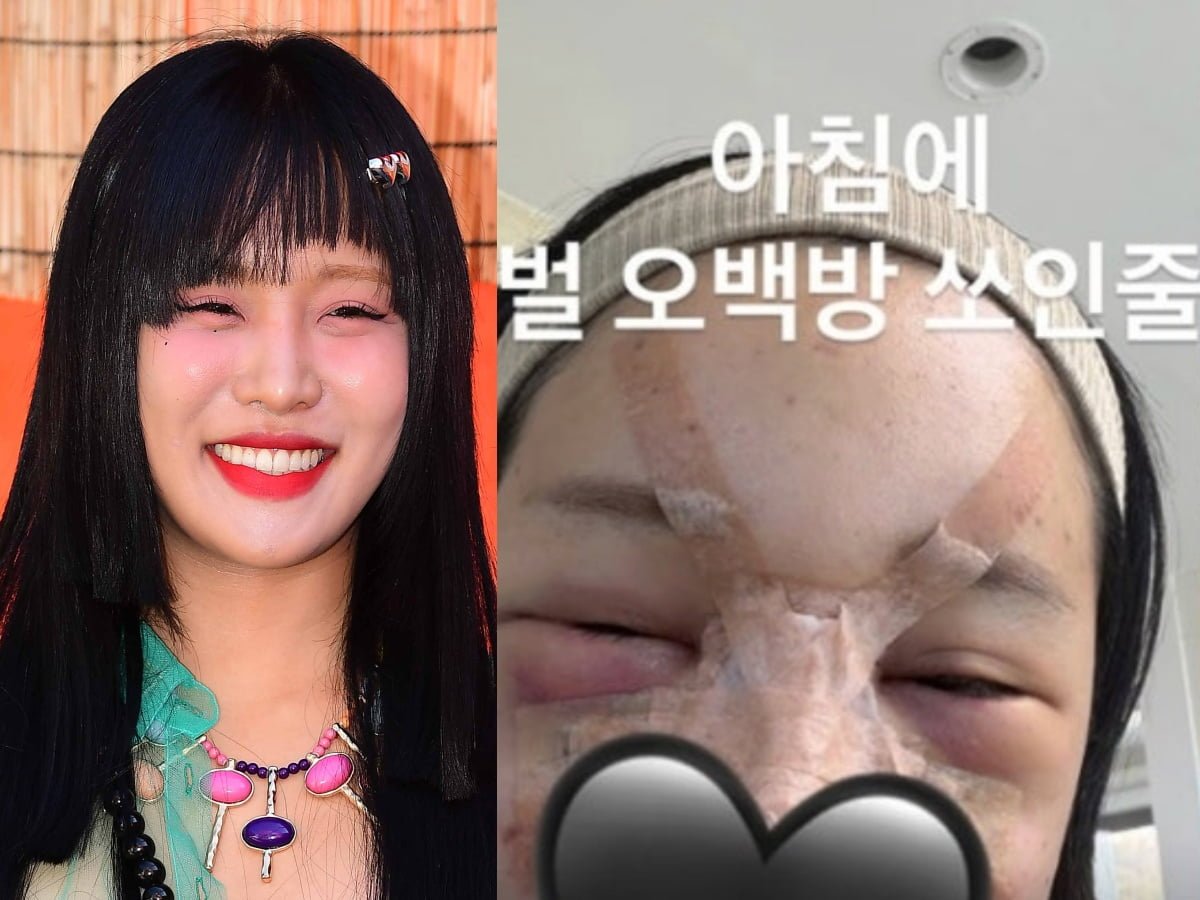 인플루언서 랄랄/사진=텐아시아 DB, 랄랄 SNS