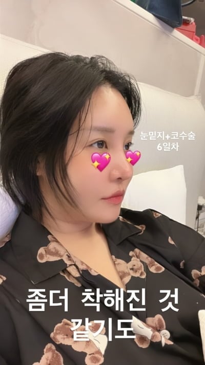 랄랄, 코 수술 6일 만에 '착해진 관상'…콧날에 베일 듯