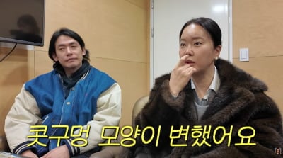 '10억 성형설' 백지영, 부작용 고백했다…"콧구멍 변해, 당장 수술대 눕고파"