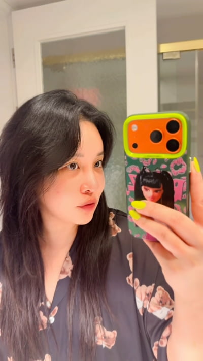 랄랄, 코 성형만 3번째라 베테랑…부기 싹 빠진 모습