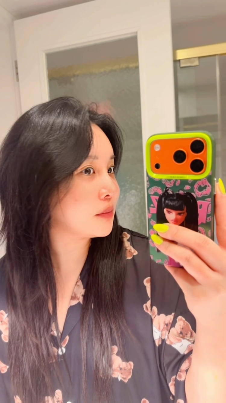 랄랄, 코 성형만 3번째라 베테랑…부기 싹 빠진 모습