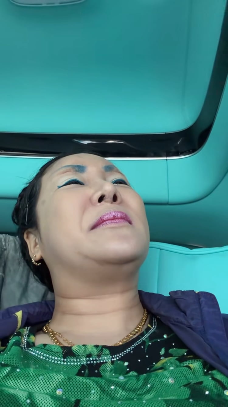 랄랄, 코+눈 밑 성형도 감행했는데…분장하니 다시 이명화