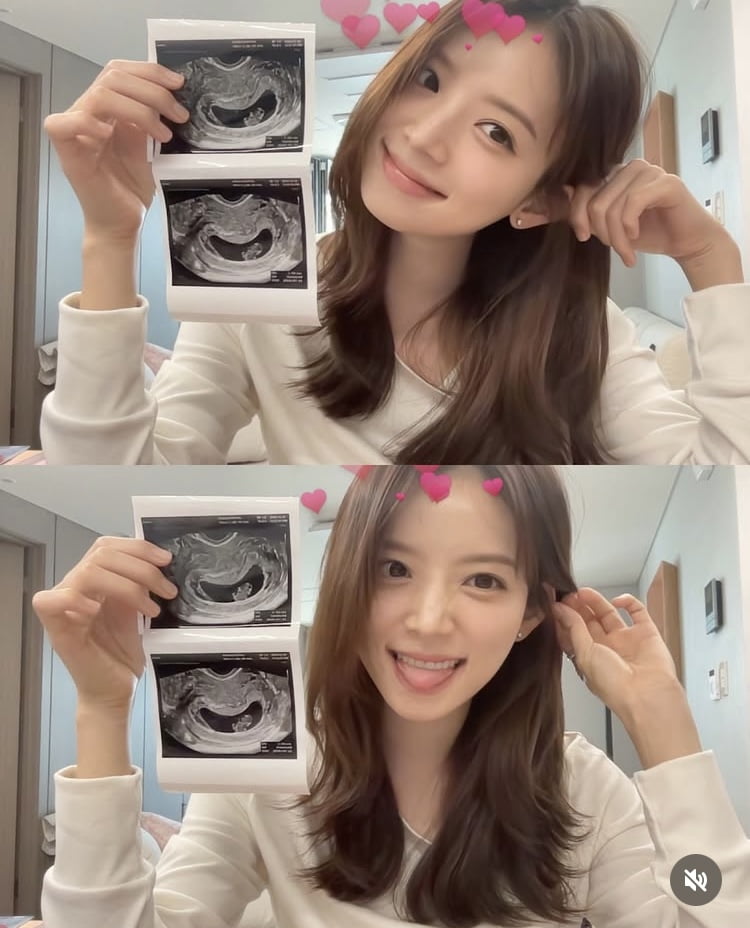 ‘태명은 포비’ 김지영, 딸 임신…DNA 빼닮은 초음파 사진