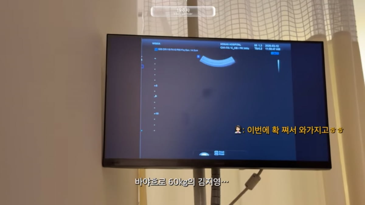 임신 19주차에 60kg 돌파해…김지영, 효율적으로 살찌라고