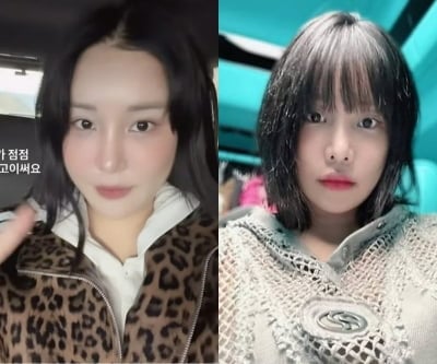 "남의 코, 내꺼 되고 있어"…랄랄 '성형수술 대성공' 대표 사례됐다