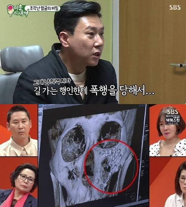 "얼굴에 철심 박아" 이상민, 남희석과 패싸움 전말 밝혔다…"뺨 한 대 때리고 구타" ('짠한형')[종합]