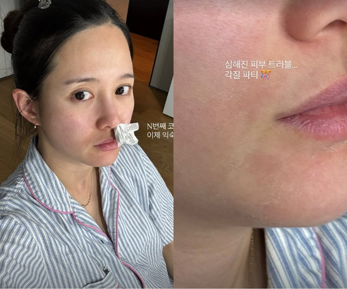 사진=남보라 SNS