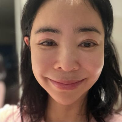 눈 퉁퉁 부은 이혜영, 폐암·담석증 이어 림프 부종도 겪었다…"건강 회복 목표"