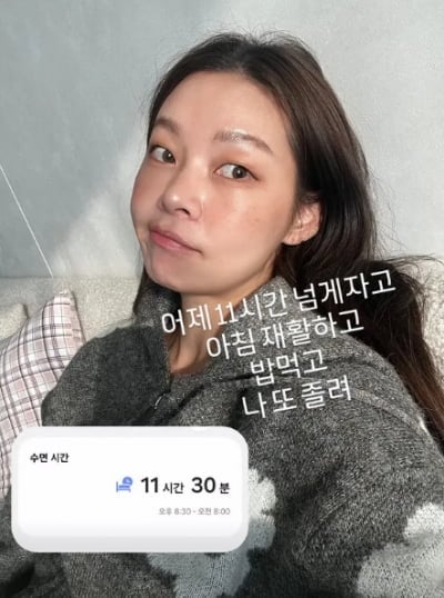 "며칠 또 못 걸어 다녀"…송해나, 본업 모델인데 재활하는 안타까운 상황