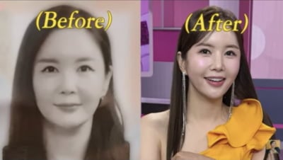 장영란, 성형 전 과거 사진 공개…"예뻐지긴 했다" ('A급')