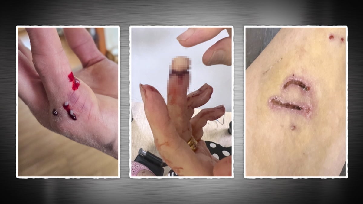 치매 할머니 손가락을 절단시킨 푸들 '동동이'의 안락사 위기 사연과 훈련사의 필사적인 교정 과정이 공개된다. 사진 제공=KBS 2TV 