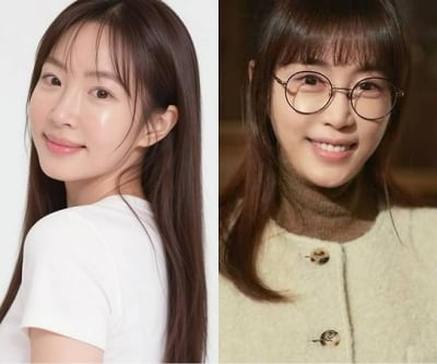 "사람들이 잘 못 알아봐"…강예원, 앞트임 복원 전 사진 보니 그럴 만도