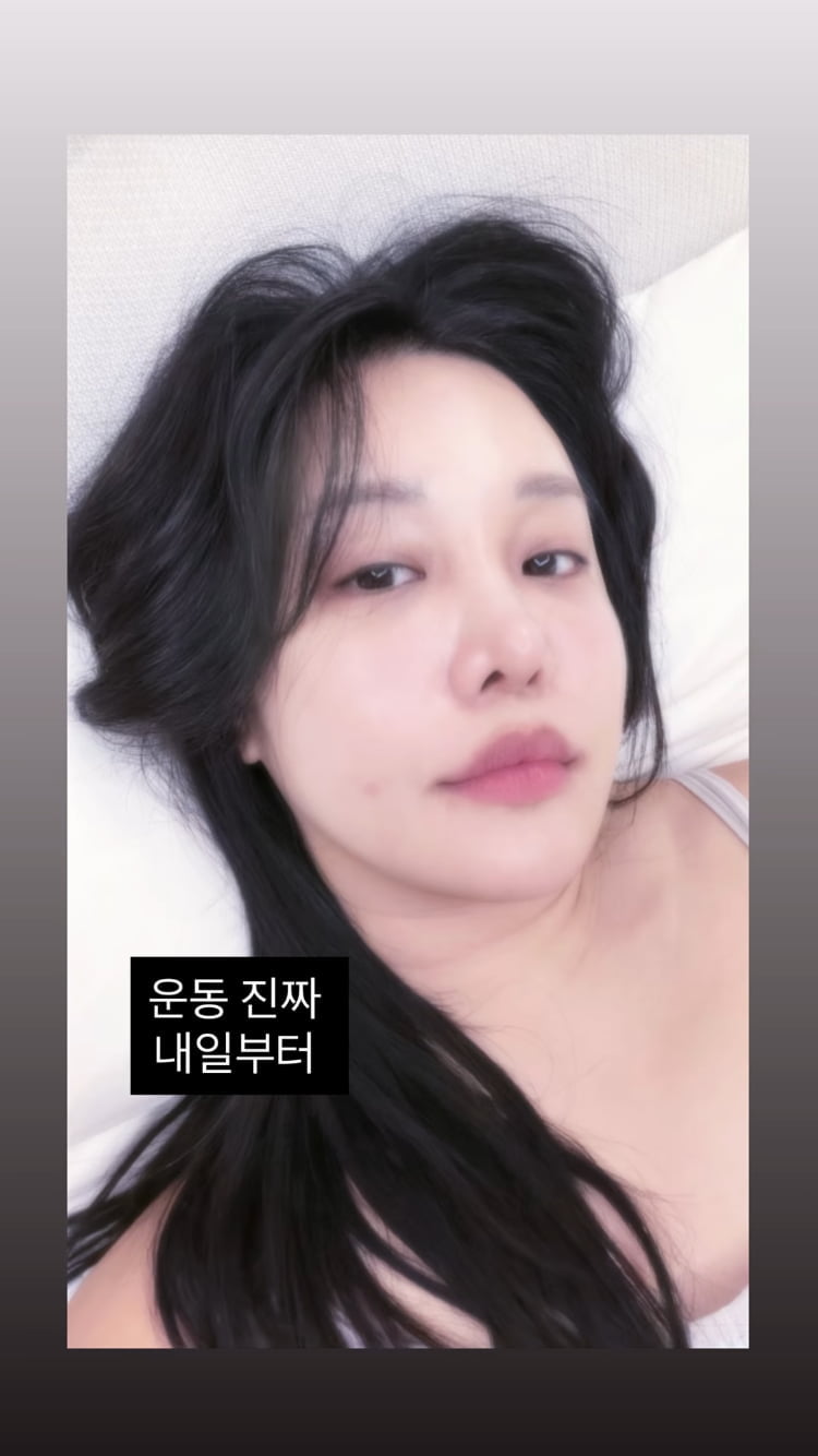 랄랄, 성형수술하고 1개월 지나니…눈밑도 코도 자연스러워