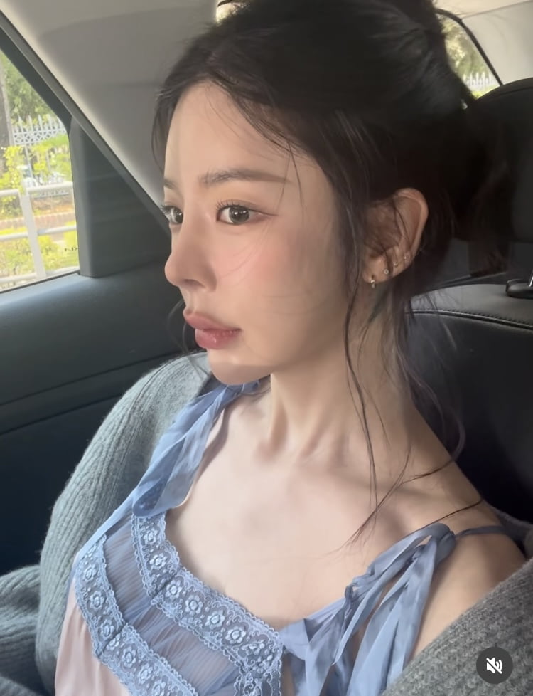 장재인, 38kg처럼 보이는데…등뼈가 나올 정도로 앙상