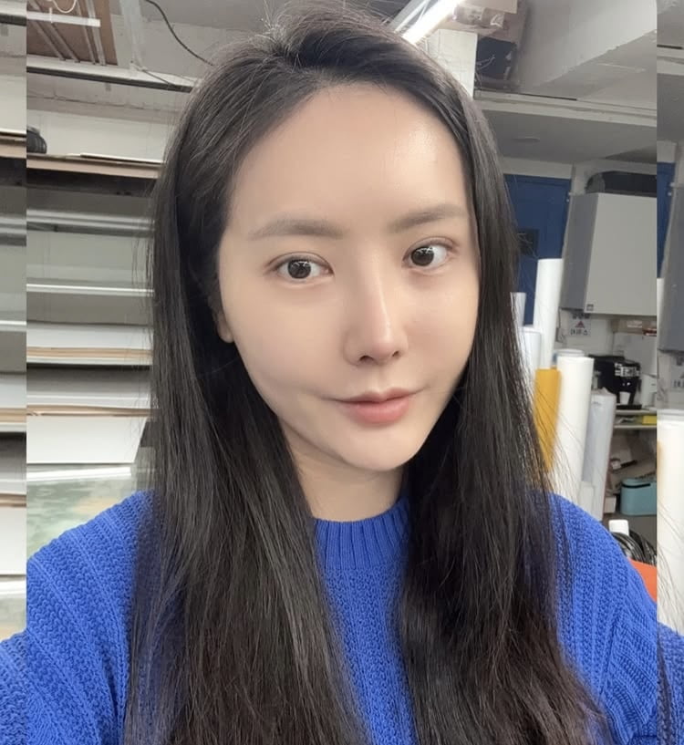 ‘돌싱’ 변혜진, 코 재수술 2주차… ♥16기 영철도 놀랄 붓기