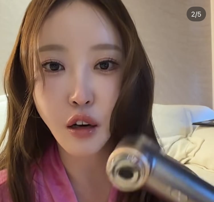 20기 정숙, 뇌 검사 받았다더니…SNS 공구는 여전, 뷰티 기기 홍보