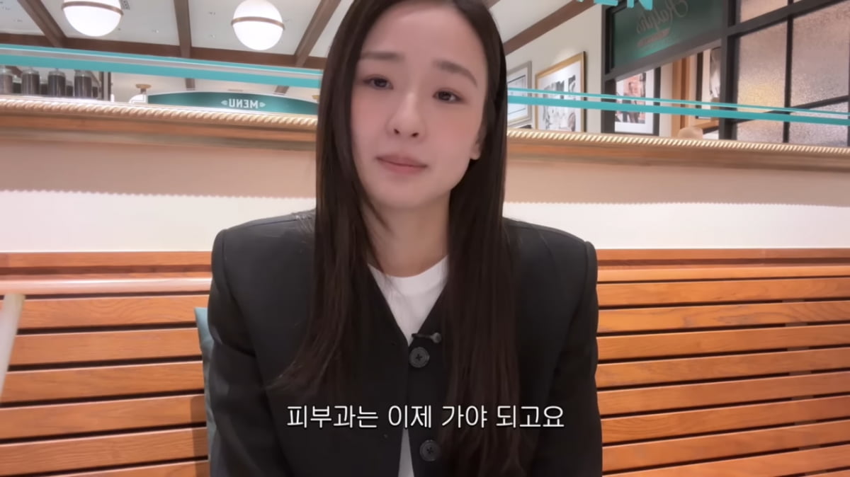 팔자주름에 보톡스 맞았다더니…손연재 “울쎄라+쥬베룩 시술받아”