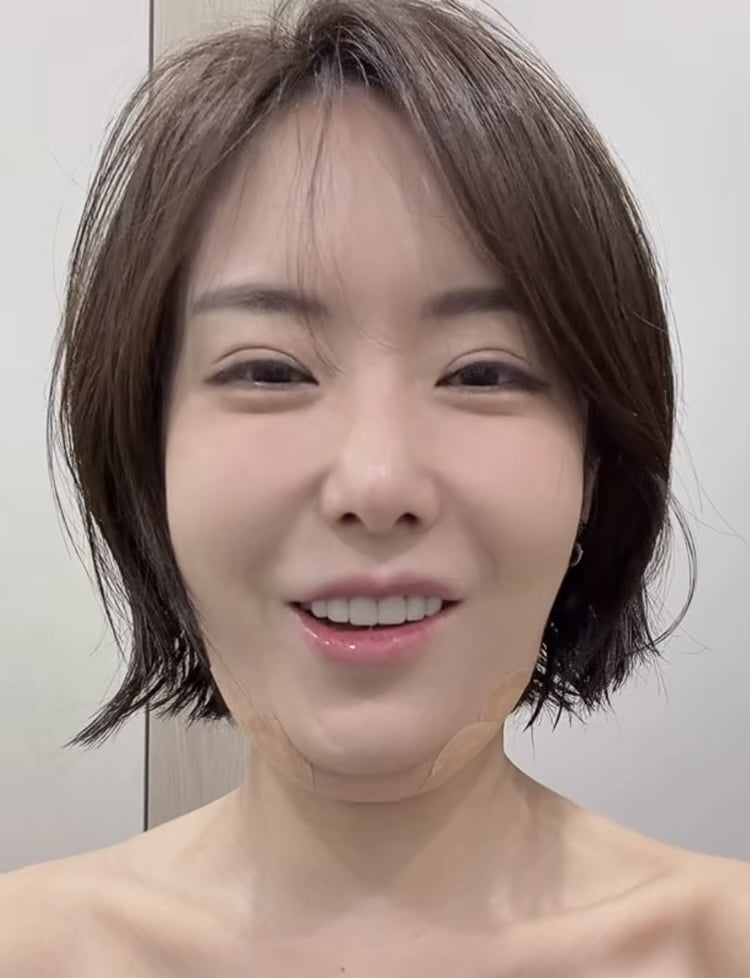 ‘가슴 성형 1000만원’ 이소라, 피부과 VIP네…이중턱 붓기 깜짝