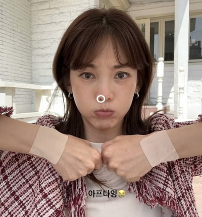 송혜교 닮은꼴, 상태가 왜이래…파스 2장이나 붙이고 입술 나온 정가은
