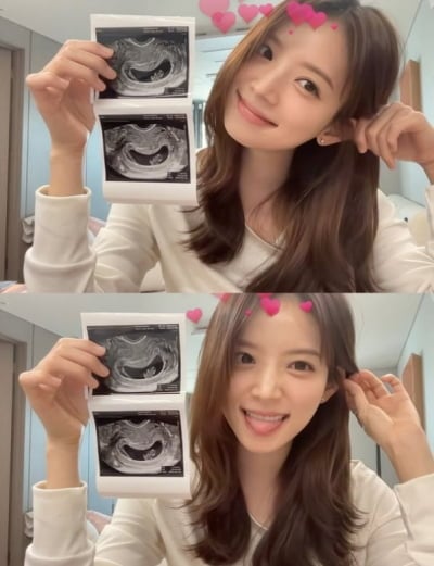 '윤수영♥' 김지영, 임산부 체력 실화인가…결혼하더니 오히려 '폭주'