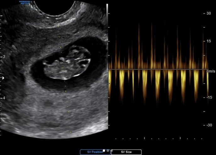 사진=고우리 SNS