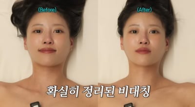 '31세 미혼' 이미주, 신부 관리 받았다…안면 비대칭 개선 "500g 빠져" ('이미주')