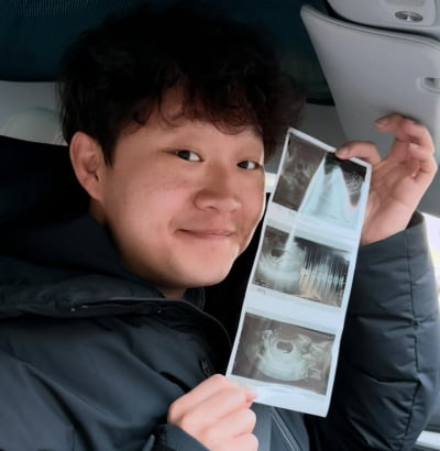 '9살 연하♥' 정재형, 결혼 4개월 만에 아빠됐다…'IQ 134' 유전자 물려 받을까