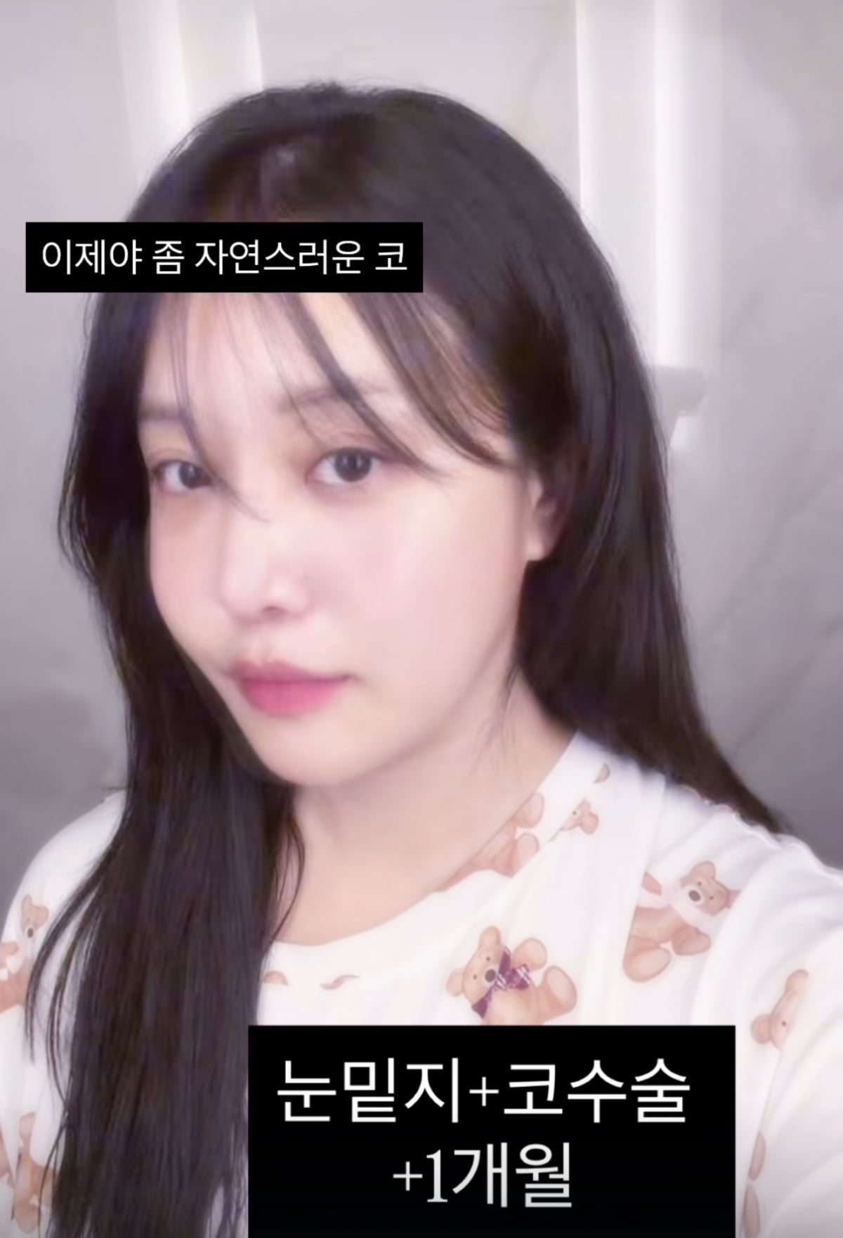 유튜버 겸 방송인 랄랄이 성형 수술 이후 근황을 전했다.
사진=유튜버 겸 방송인 랄랄 SNS