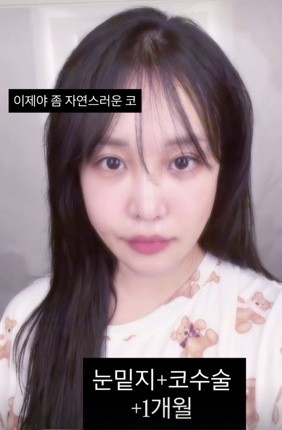 유튜버 겸 방송인 랄랄이 성형 수술 이후 근황을 전했다.
사진=유튜버 겸 방송인 랄랄 SNS