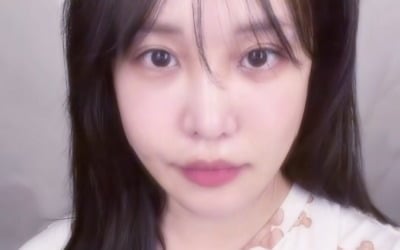 랄랄, 코 성형+눈밑지 후 확 변했다…"이제야 좀 자연스러워"