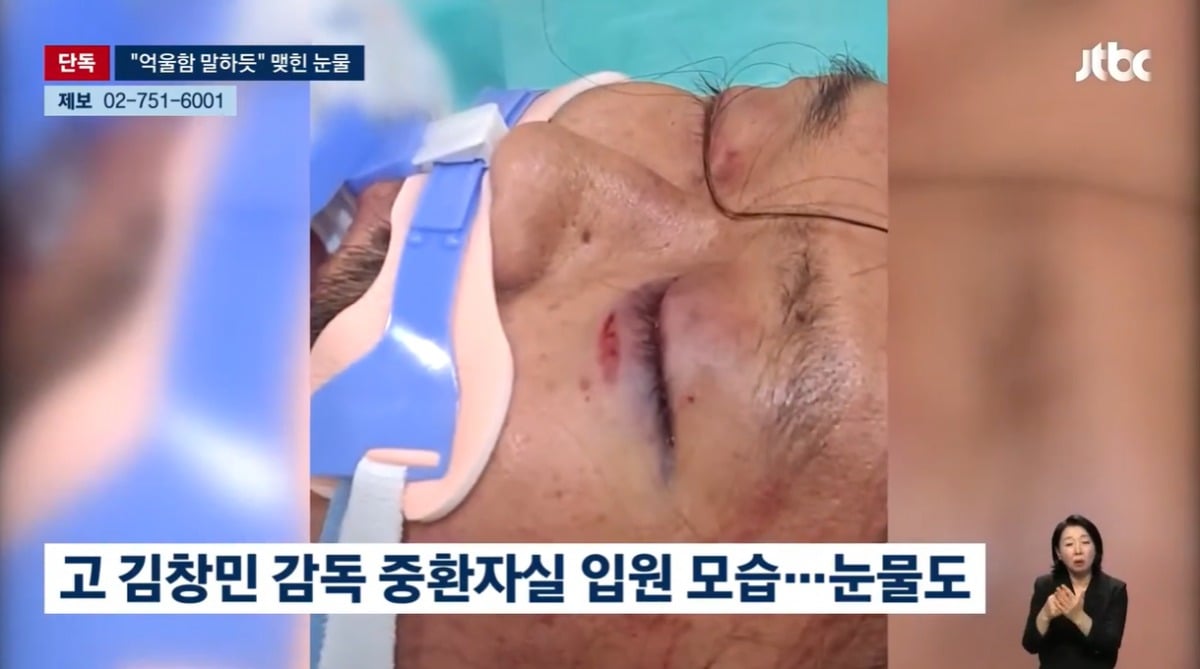 김창민 감독의 입원 당시 사진이 공개됐다. / 사진=JTBC '뉴스룸' 영상 캡처