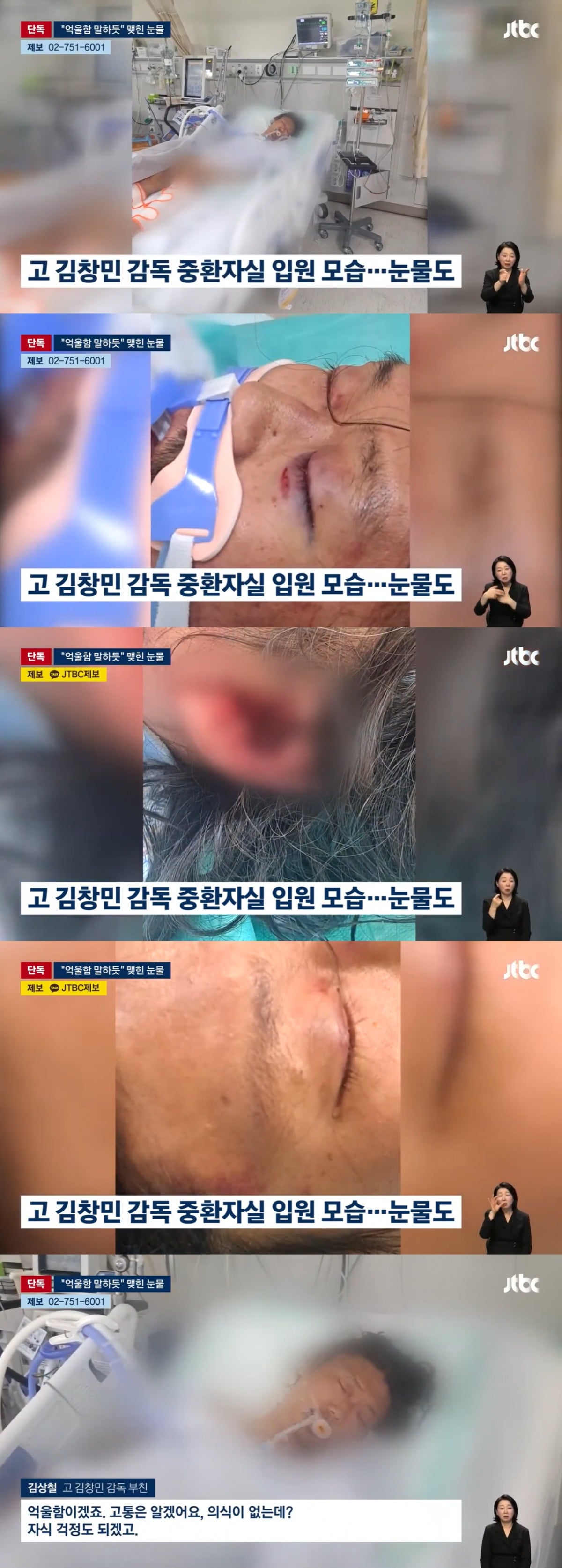김창민 감독의 입원 당시 사진이 공개됐다. / 사진=JTBC '뉴스룸' 영상 캡처