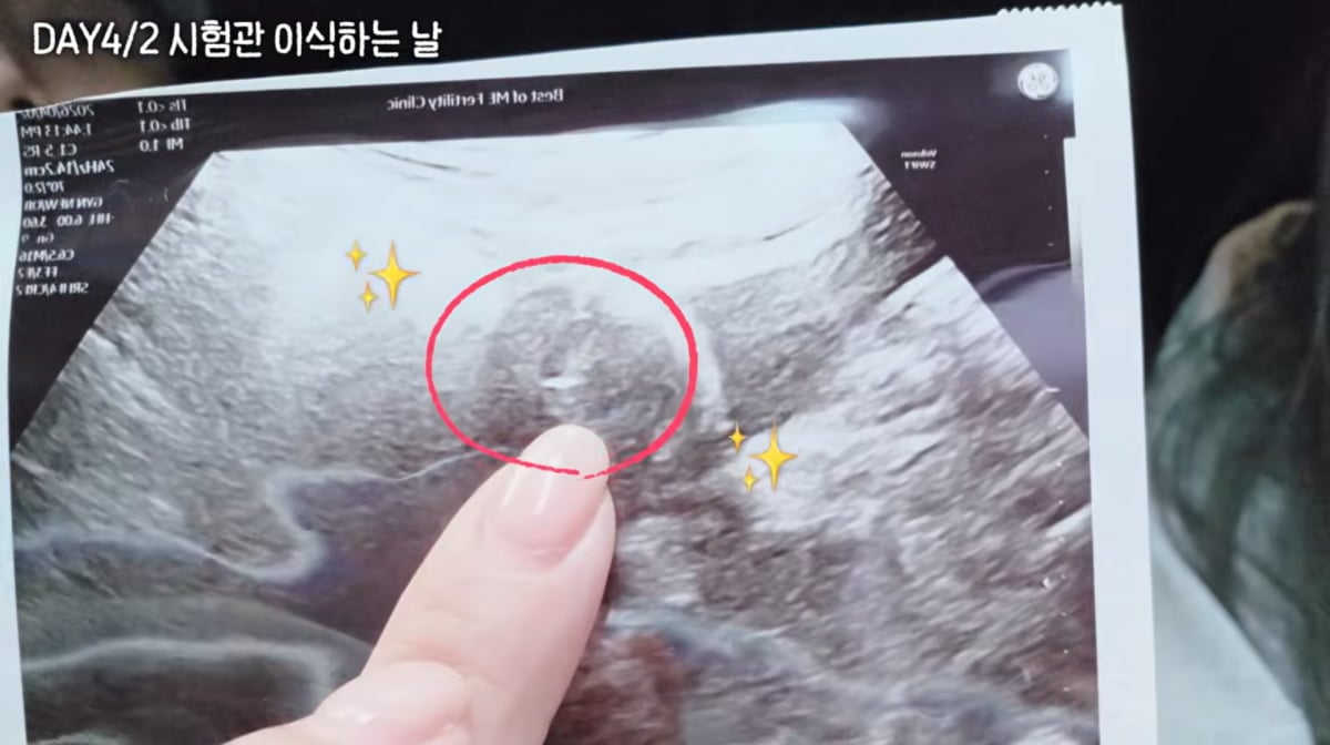 사진=유튜브 '일리네 결혼일기'