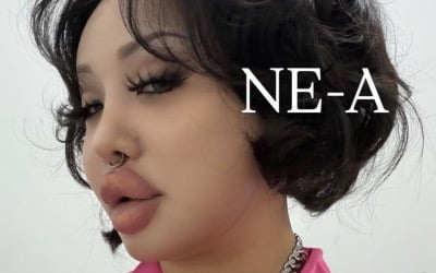 랄랄, '눈밑지+코성형' 2달 만에 벌에 쏘인듯한 입술…"필러 부작용인줄"