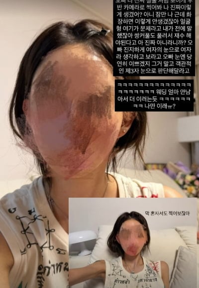 최준희, 윤곽 시술+눈 트임까지 했는데…"오빠, 나 얼굴 여기 문제라고 말했잖아"