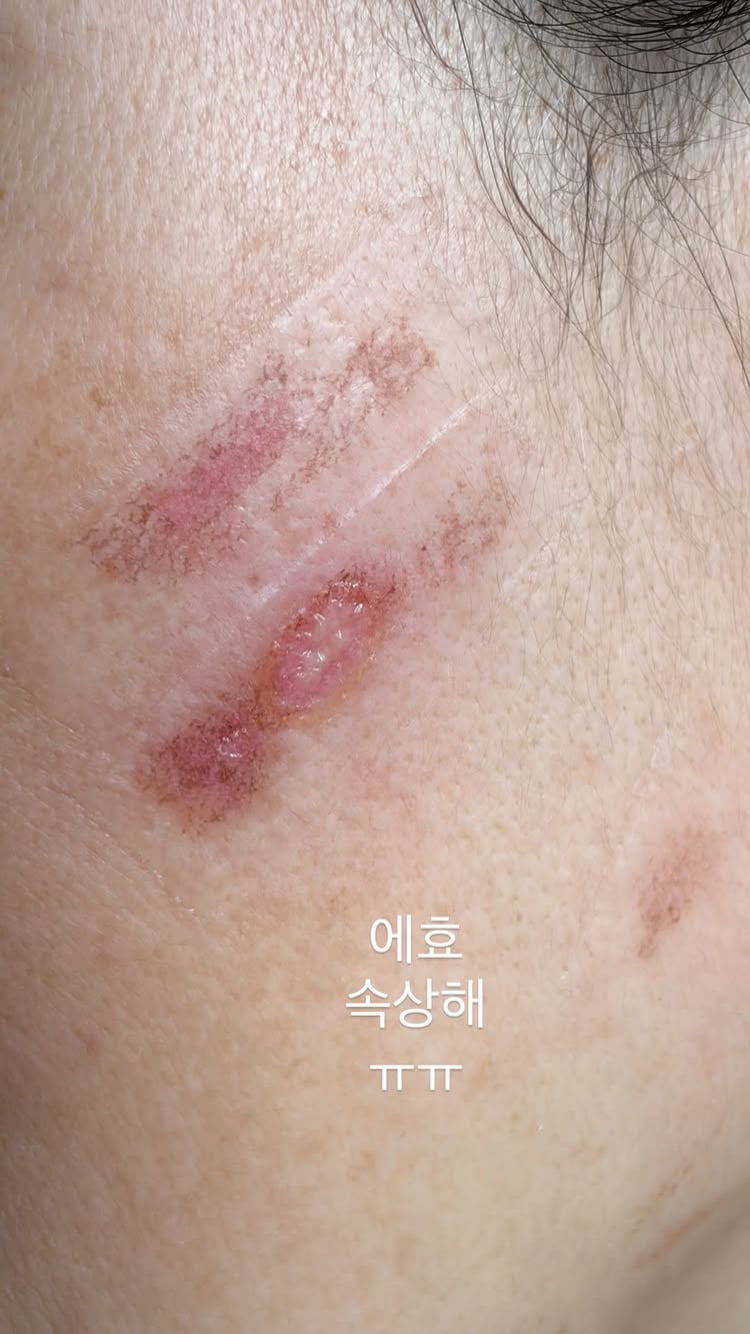 ’돌싱‘ 이아영, 변호사랑 재혼 앞뒀는데…모친, 의료사고 당해