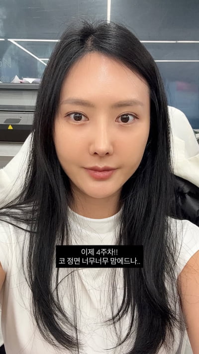 ‘돌싱’ 변혜진, 코 재수술 했다더니…이제 4주차, 붓기가 없네