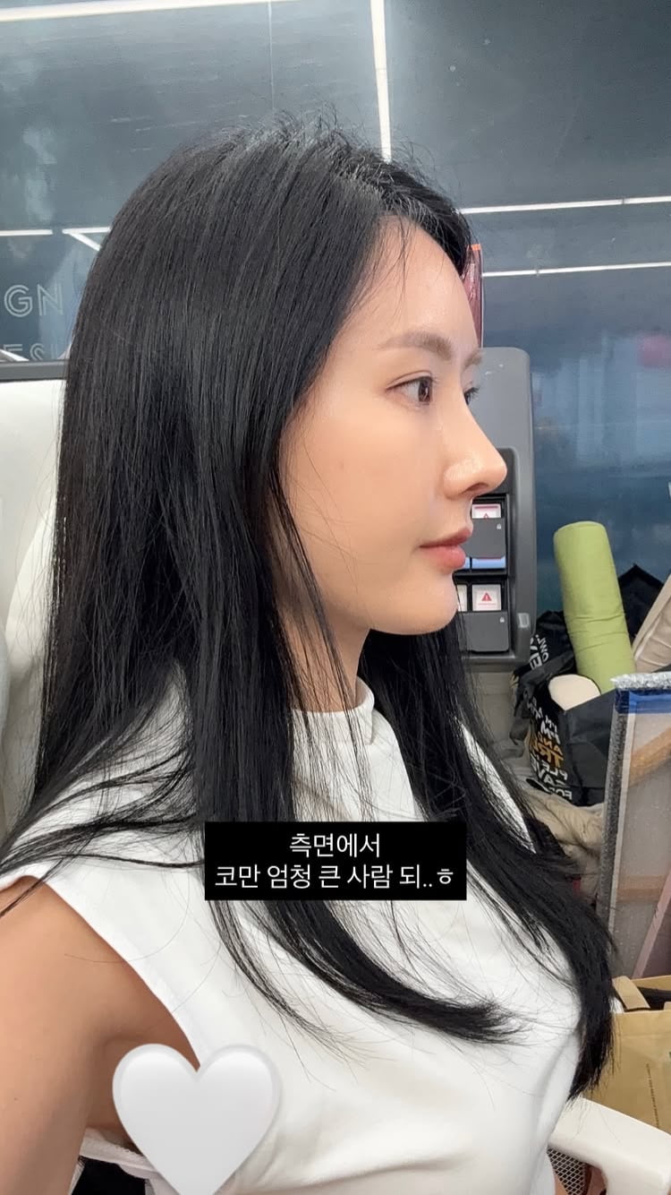 ‘돌싱’ 변혜진, 코 재수술 했다더니…이제 4주차, 붓기가 없네