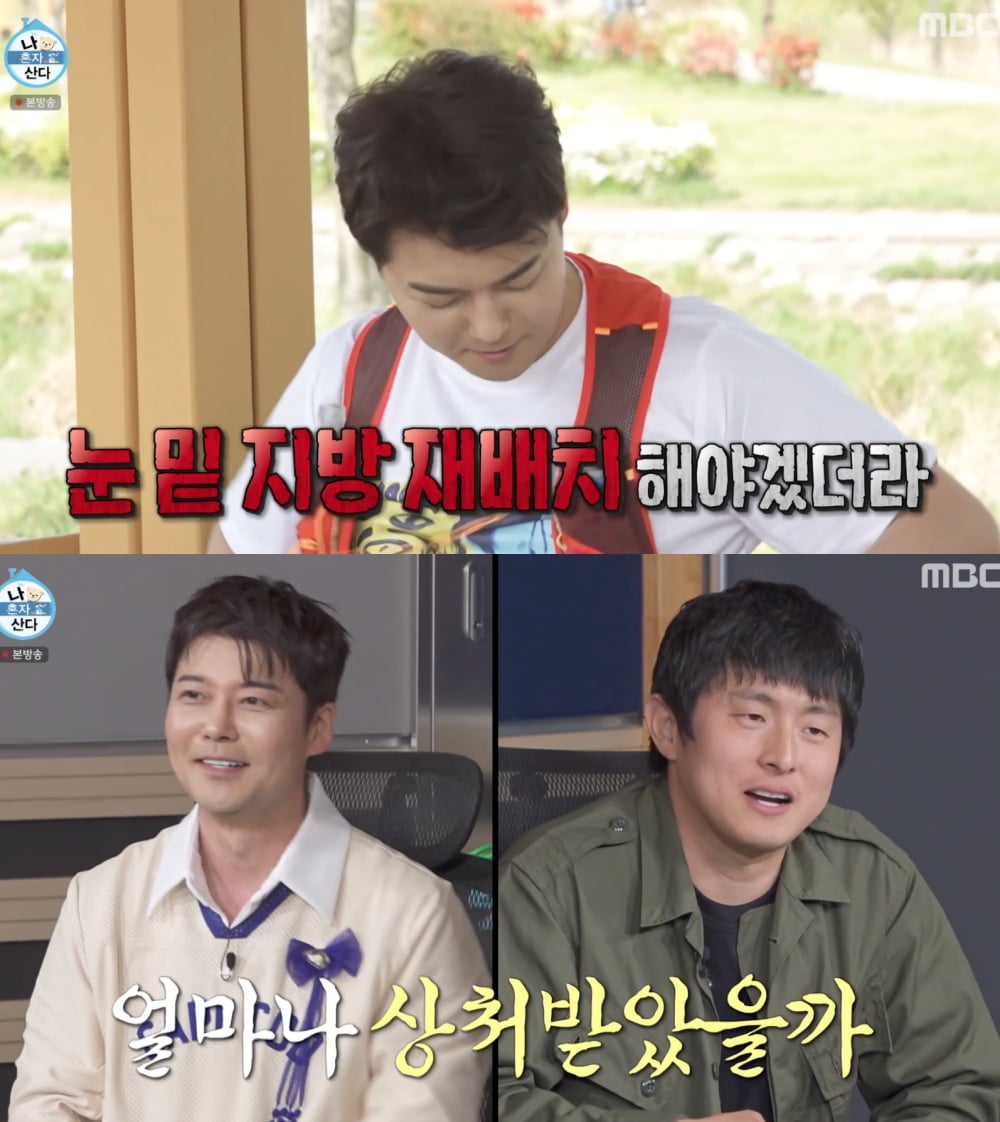 “눈밑지 한건데” 배나라, 성형고백…외모지적 전현무 ‘깜짝’ (‘나 혼자 산다’)